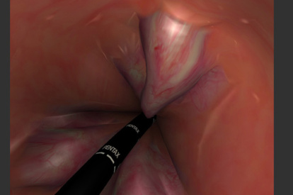 Módulo de Sigmoidoscopia Flexível