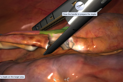 Modulo de Apendicectomia