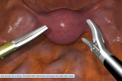 Modulo de Ginecologia