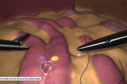 Modulo de Cirurgia Bariatrica